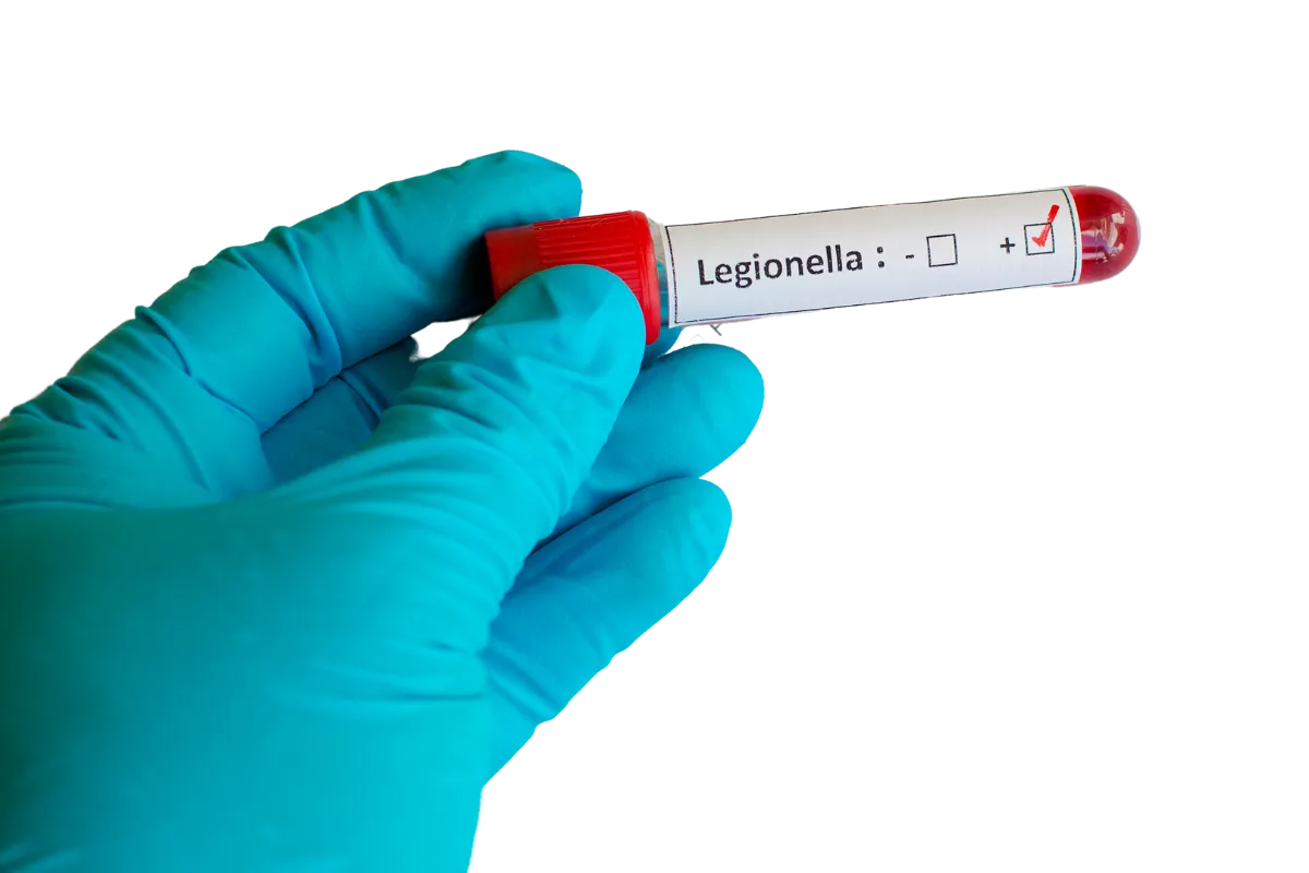 control de legionella imagen